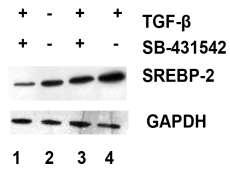 Β.2Α.7 Επίδραση φυσιολογικών χονδροκυττάρων με TGF β1 και ταυτόχρονη αναστολή του υποδοχέα του με τη χρήση φαρμακευτικού αναστολέα (SB 431542) για τη μελέτη της έκφρασης των SREBP 2, MMP 13 και