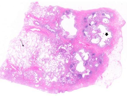 Histopathological criteria