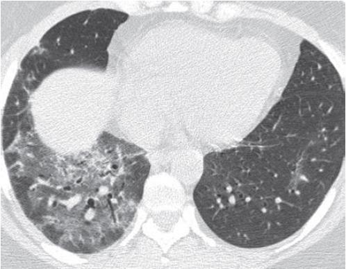 opacities in