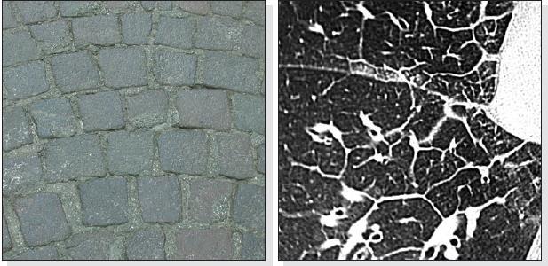 Reticular