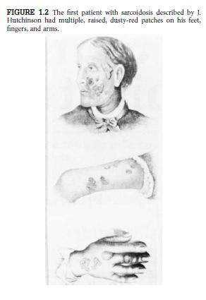 Caesar Boeck,