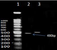 میکرلیتر +5 میکرلیتر آباکسیژنه %31( به هر چاهک Detection buffer اضافه چند دقیقه اتاقک تاریک نگهداری گردید.