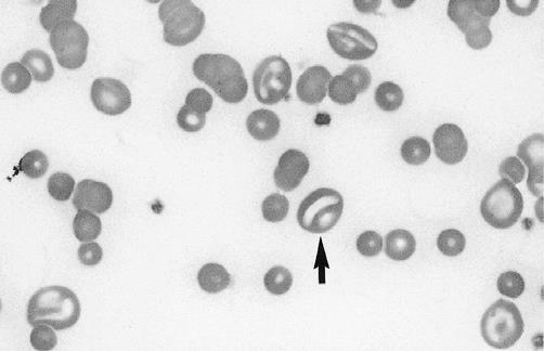 Leptocitele (stomatocitele) sunt eritrocite cu diametrul longitudinal crescut şi grosime scăzută.