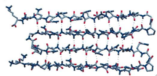 Nalaganje proteinskih fibrilov in tvorba agregatov Amiloid: amiloidni fibrili so hidrofobni filamenti, širine ~10nm in dolžine