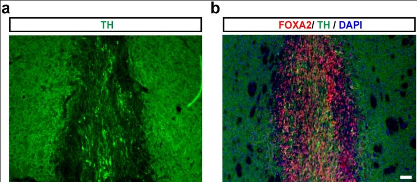 Supplementary Figure 8: Immunochistochemical analysis of short-term (6 weeks) in vivo survival studies in adult intact (unlesioned) mouse striatum (NOD-SCID IL2Rgc null strain).