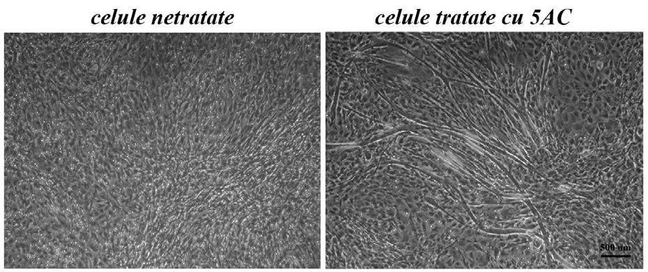 Figura 12: Imagine de microscopie in contrast de faza aratand prezenta miotubilor formati in cultura de celule stem mezenchimale tratate cu 5-azacitidina dupa deprivarea de ser.