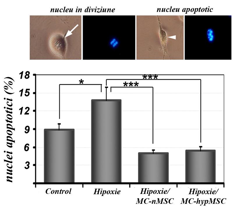 Figura 16: Determinarea cantitativă a apoptozei în miocitele cardiace după expunerea la hipoxie în prezenţa şi absenţa mediului condiţionat recoltat de la MSC.