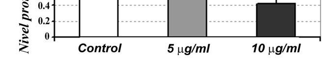 Figura 2: Cuantificarea prin Western Blot a nivelului expresiei proteice a Bcl-2 după tratamentul CMC cu 25-HC. II.