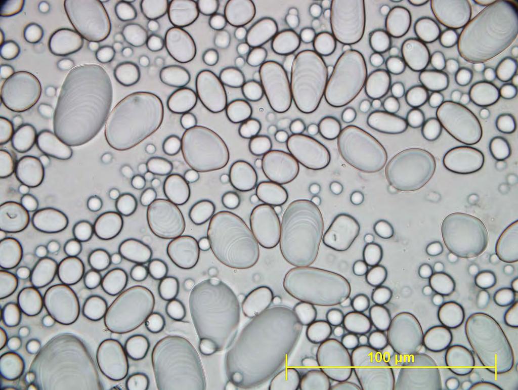 Solanum tuberosum škrobna zrna - enostavna