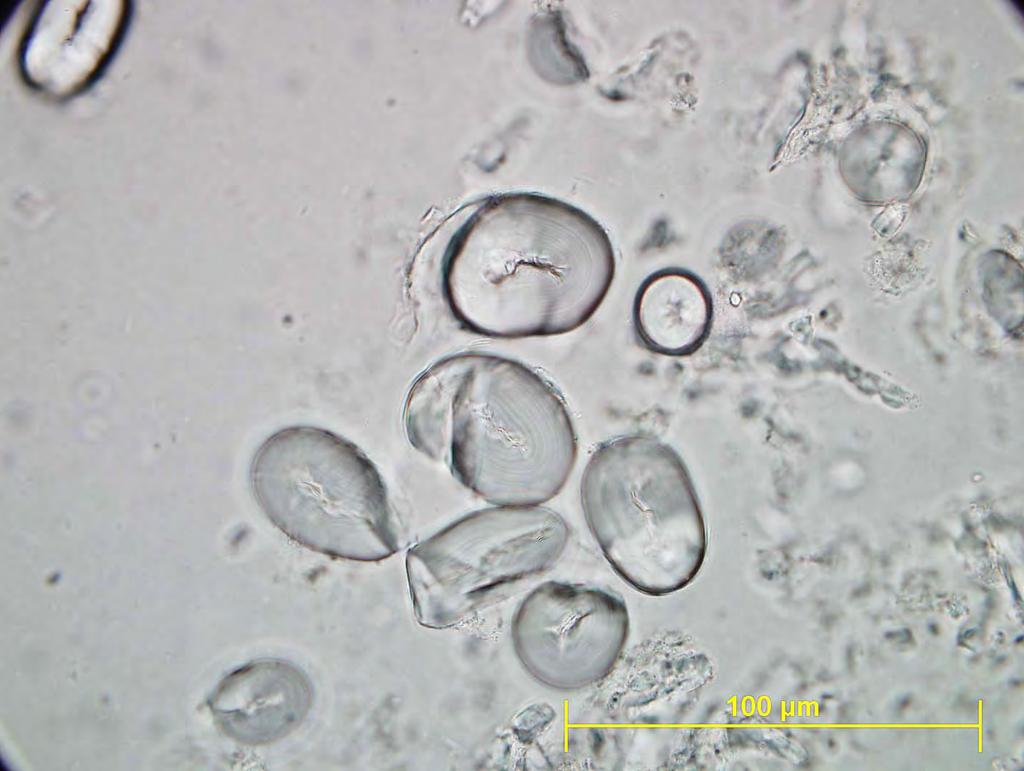 Phaseolus vulgaris škrobna zrna - enostavna