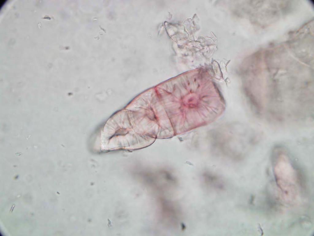 Pyrus communis sklereide - mehanska tkiva - sklerenhimi