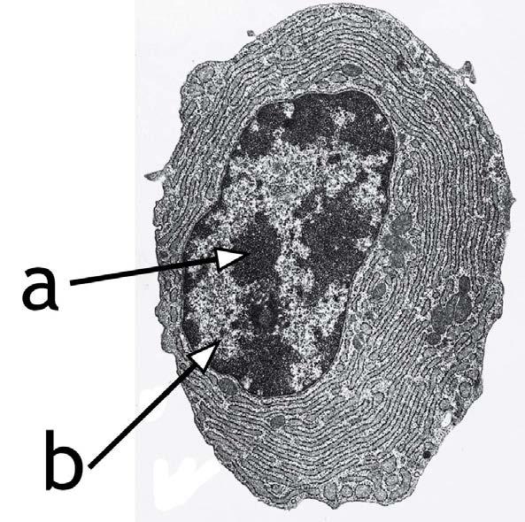 Küsimus 5 Parempoolsel pildil on kujutatud ühe raku elektronmikrofotot. Heterokromatiin on tähistatud tähega a ja eukromatiin tähega b.