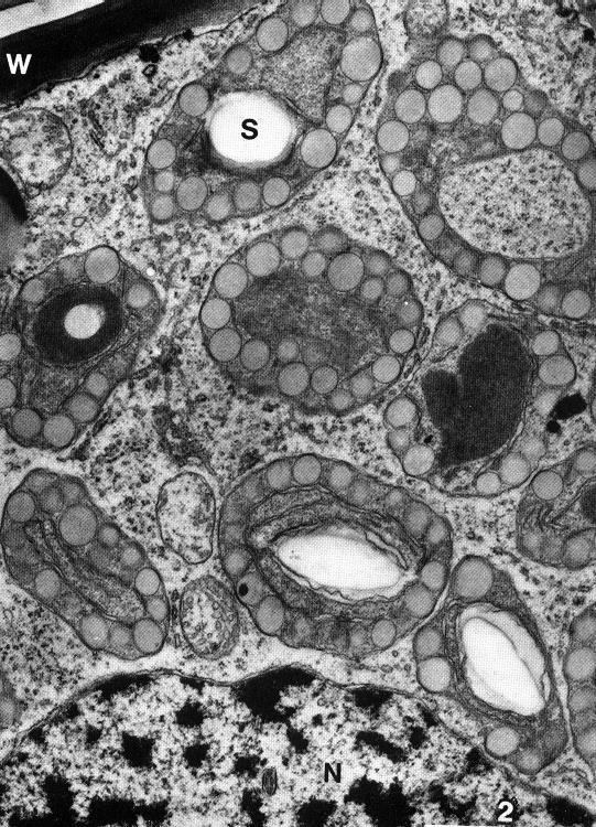 Tipovi kromoplasta globularni