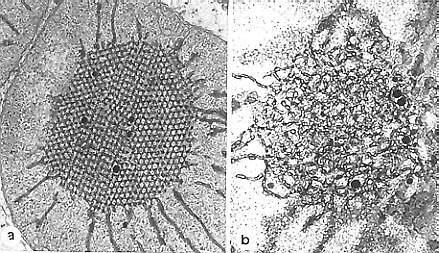 ETIOPLASTI Prolamelarno tijelo Tilakoidne membrane ETIOPLASTI se razvijaju u tami, sadrže prolamelarno tijelo i protoklorofil iz kojeg se na svjetlosti razvijaju tilakoidne membrane