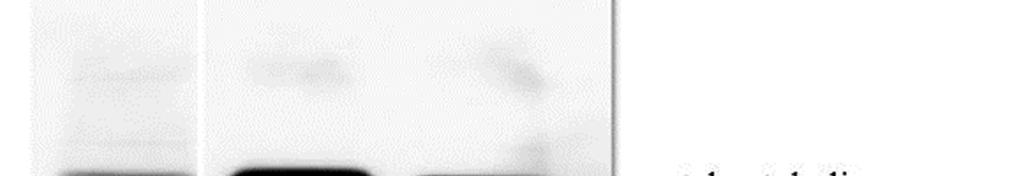 mmol) hydroxylamine hydrochloride and 295 mg (5.3 mmol) potassium hydroxide were used according to method C. Overall yield: 80 mg (10%). Mp: 160-162 C. 1 H-NMR (DMSO-d 6, 400 MHz): δ 11.