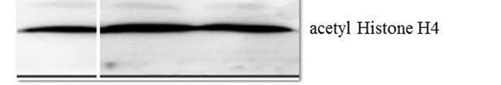 45 (m, 1H, 4 -H). 13 C-NMR (100 MHz): δ 176.2 (5-C), 163.7 (CONH), 154.1 (3-C), 145.4 (4 -C), 138.9 (1 -C), 129.6 (3 -,5 -C), 129.5 (4 -C), 129.1 (3 -,5 -C), 128.2 (2 -,6 -C), 127.4 (2 -,6 -C), 122.