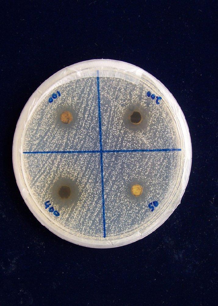Rajah 3.7 : Aktiviti antimikrob ekstrak metanol Cassia alata L. terhadap Bacillus subtilis.
