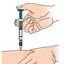 E) Priprava injekcije 1 - Izberite mesto injiciranja (glejte nasvet na začetku in diagrame na koncu tega dodatka) in dogodek zabeležite v kartici uporabe zdravila.