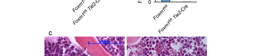 (a-b) Analysis of ablation of Foxm1 as determined by semiquantitative