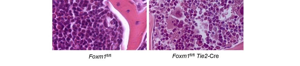 (b) from BM cells from both Foxm1 fl/fl Tie2-Cre and Foxm1 fl/fl mice.