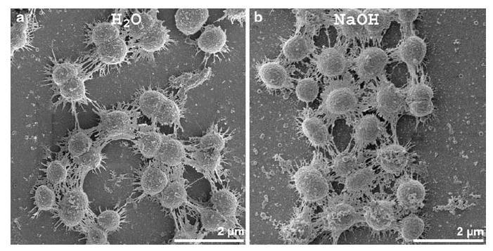 Vpliv okolja na obliko biofilma D.