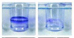 biofilmov rast