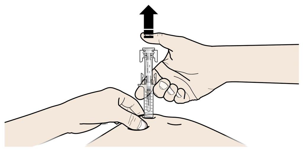 ŠKLJOC Važno je gurati do kraja uz škljocanje kako bi se primijenila cijela doza. C OTPUSTITE palac.