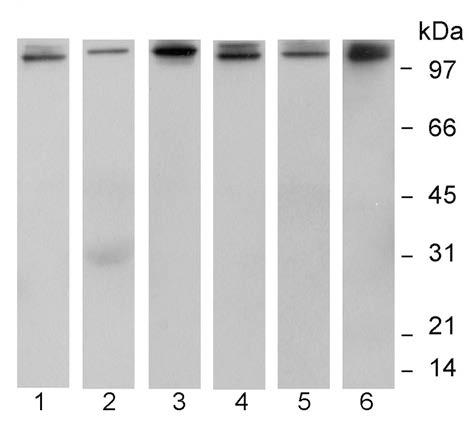 4.3.3 Ispitivanje formi IGFBP-1 metodom lektinske afinitetne hromatografije Pošto je traka u IGFBP-1 imunoblotu sa najvećom molekulskom masom postajala vrlo tanka i slabog intenziteta u redujućim