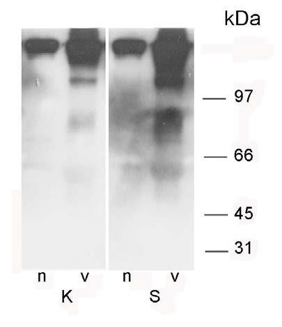 4.5.2 Ispitivanje formi IGFBP-1 kod sportista imunoafinitetnom hromatografijom Iako u uzorcima seruma sportista nisu nađene razlike u koncentraciji α2m u odnosu na kontrole, ipak su bile moguće