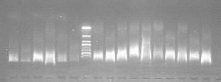 2. ILLAMENTO DO ADN A partir de biopsias tisulares das mostras obtidas, o ADN foi illado a partir dun número representativo e adecuado para as análises analizadas, utilizando o Kit de Molusco ADN