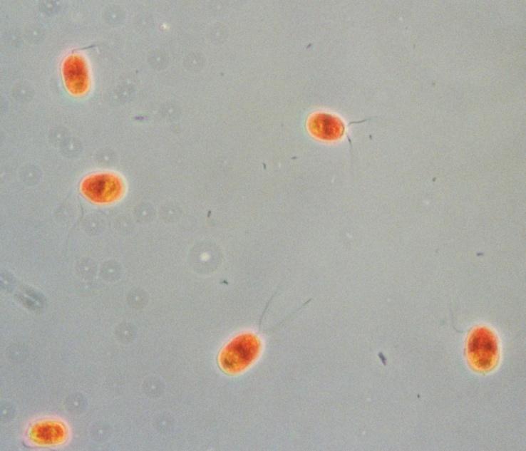 nivalis veoma kisele vode Dunaliella acidophila veoma