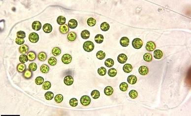 TETRASPOROPHYCEAE kolonijske, retko jednoćelijske sa hemimonadnim nepokretnim