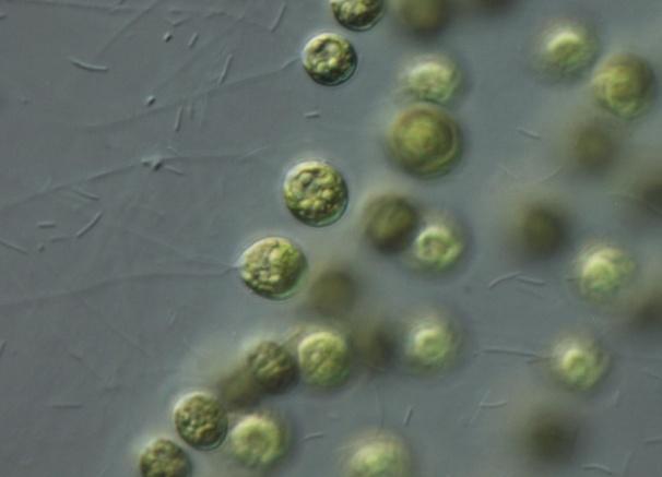 (pseudobičevi) nedostaju 2 centralne mikrotubule, nepokretne i duže od bičeva
