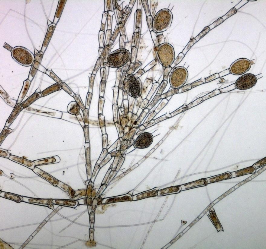 (2) heterotrihalni parenhimski