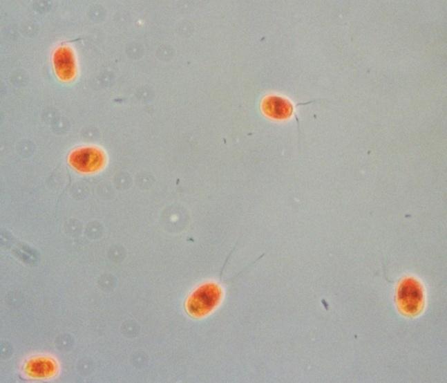 Chlamydomonas nivalis veoma kisele vode Dunaliella