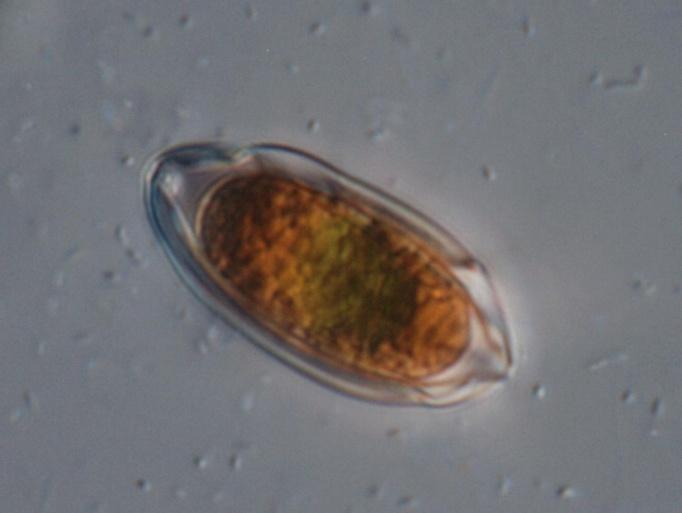 CHLAMYDOPHYCEAE Chlamydomonadales Chlamydomonas jednoćelijske, monadne sa 2 biča uvek se kreću prema umerenoj količini svetlosti, a suprotno od