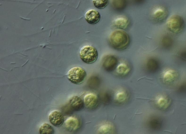 TETRASPOROPHYCEAE Tetrasporales Tetraspora kolonija sa dobro