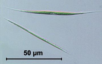 CHLOROCOCCOPHYCEAE Chlorococcales Ankistrodesmus jednoćelijska ili cenobijska (4) ćelije