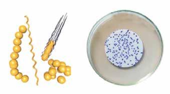 rtc vitroids PREPARATION: Rehydrate the disc with a common phosphate buffer, or place the disc onto a solid or into a liquid medium. The rehydration process takes approximately 10 minutes.