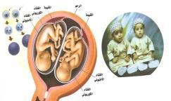 ا ١ تواد التعليمية صور معروضة الك تونيا سادسا :.