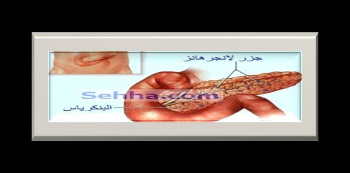 نشاط ( 1