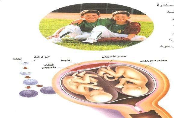 قارين ب ت التوائم من حيث نوع