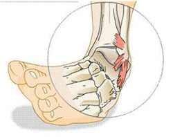 Diseases pictures.