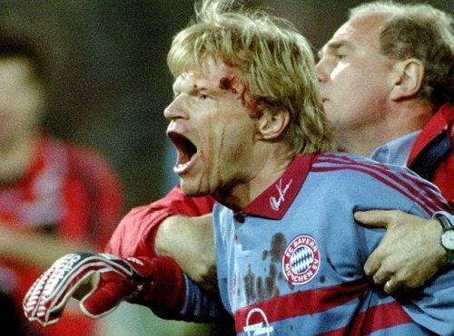 شكل :)17( الجروح الرضية عن