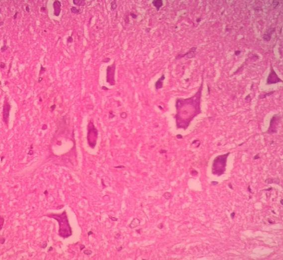 Alpha motorneuron density/mm3 18 00 16 00 14 00 12 00 10 00 8 00 6 00 4 00 2 00 0 C o ntro l *** ** C o m p ressio n 50 m g /kg 75 m g/kg 100 m g /kg