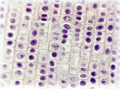 DNA tvoria dve chromatidy, ktoré zostávajú spojené v oblasti centroméry. V interfáze sú však chromozómy rozvinuté a nie je možné ich morfologicky rozoznať.