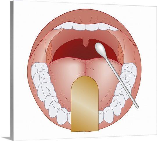 3. Bris ždrijela (tonzila i/ili stražnje stijenke ždrijela) uzeti tako da se izbjegne kontakt s jezikom, uvulom i bukalnom sluznicom 4.