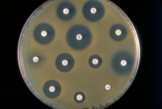 Ispitivanje antimikrobne osjetljivosti - primijeniti važedi EUCAST standard Izdavanje nalaza Mikroskopija Rok za javljanje mikroskopskog nalaza Fusobacterium