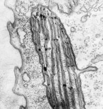 EUGLENOPHYTA hloroplasti sa 3 membrane omotača i po 3 grupisana tilakoida