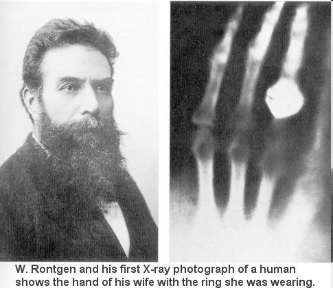 Spektar X-zraka Emitirana X- zraka Katoda Anoda Upadni elektron 1895. godine W. Röntgen opazio je nevidljivo (X-zrake) zračenje koje nastaje pri izboju u cijevi s razrijeđenim plinom.